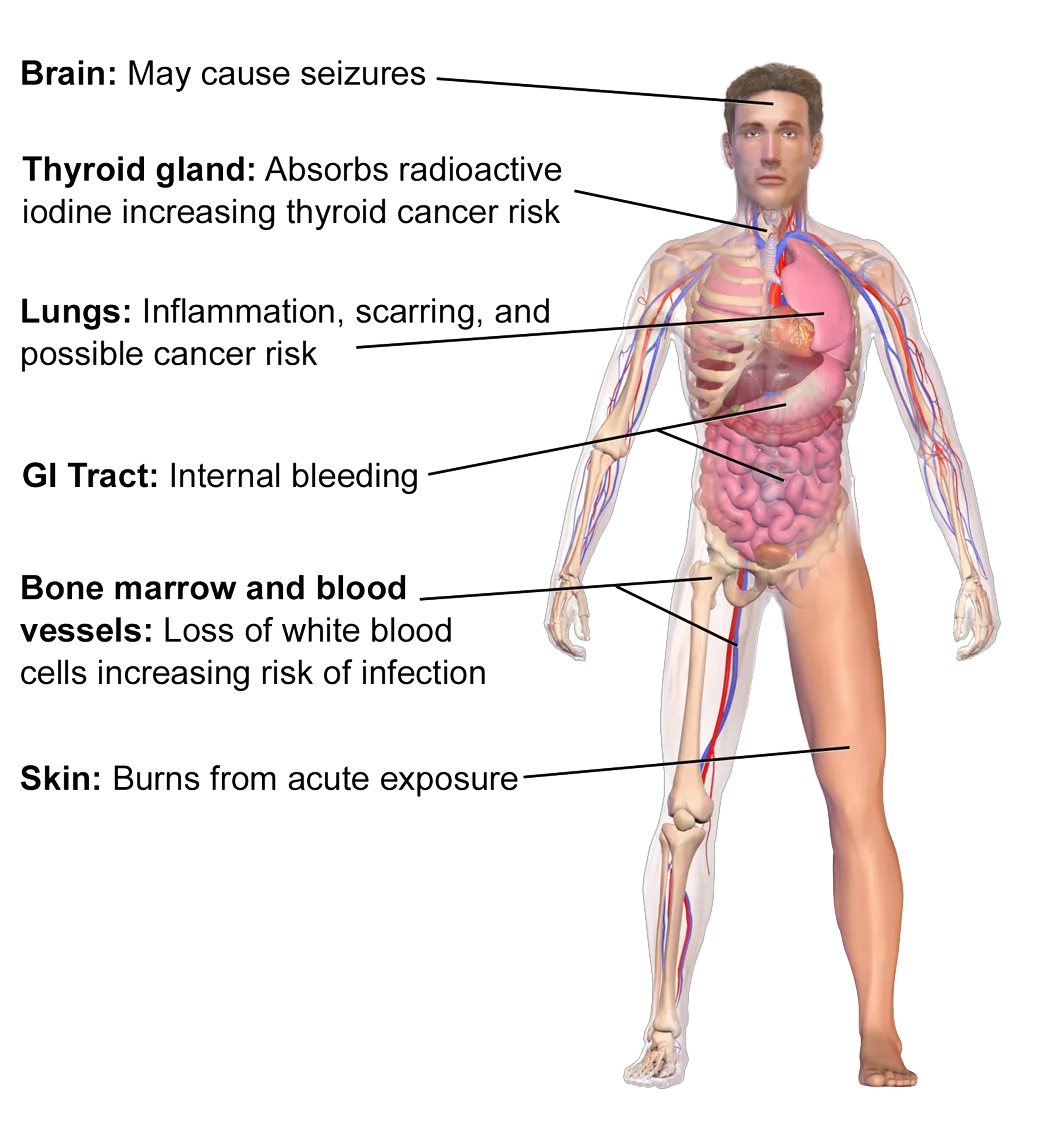 placeholder Illustration accompanying What PPE should be worn for radiation?